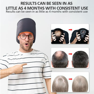 660nm نمو الشعر قبعة LED العلاج الضوء الأحمر و 270 LED الضوء الأحمر والعلاج بالليزر قبعة